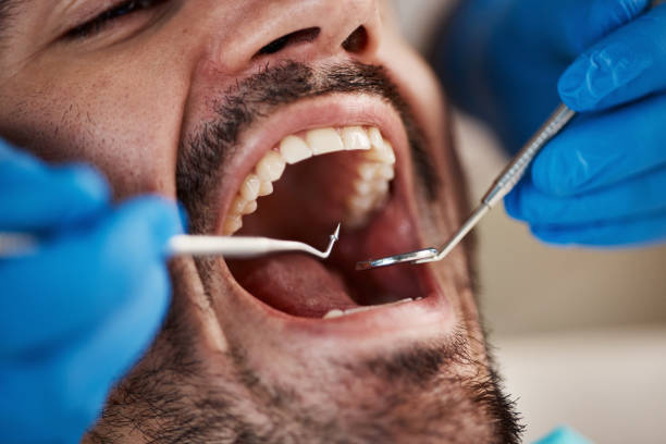 Best Emergency Dental Services for Seniors in Williamstown, WV